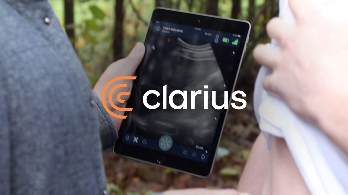 Clarius uses AMD SoCs to Build Handheld Ultrasound Device